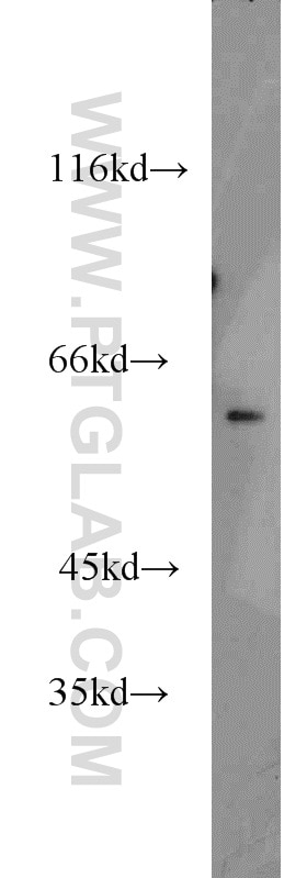 Western Blot (WB) analysis of mouse kidney tissue using NKD2 Polyclonal antibody (16699-1-AP)