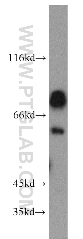Western Blot (WB) analysis of HEK-293 cells using NKD2 Polyclonal antibody (16699-1-AP)