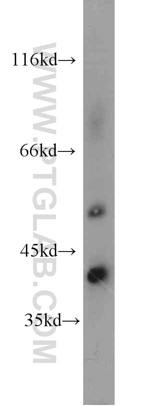 Western Blot (WB) analysis of mouse colon tissue using NKD2 Polyclonal antibody (16699-1-AP)