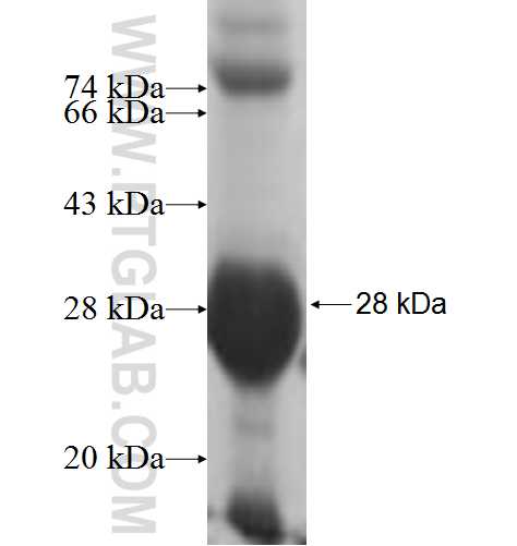 NKIRAS1 fusion protein Ag5375 SDS-PAGE