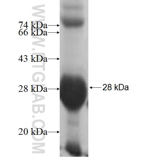 NKIRAS1 fusion protein Ag5375 SDS-PAGE NKIRAS1 fusion protein Ag5375 SDS-PAGE