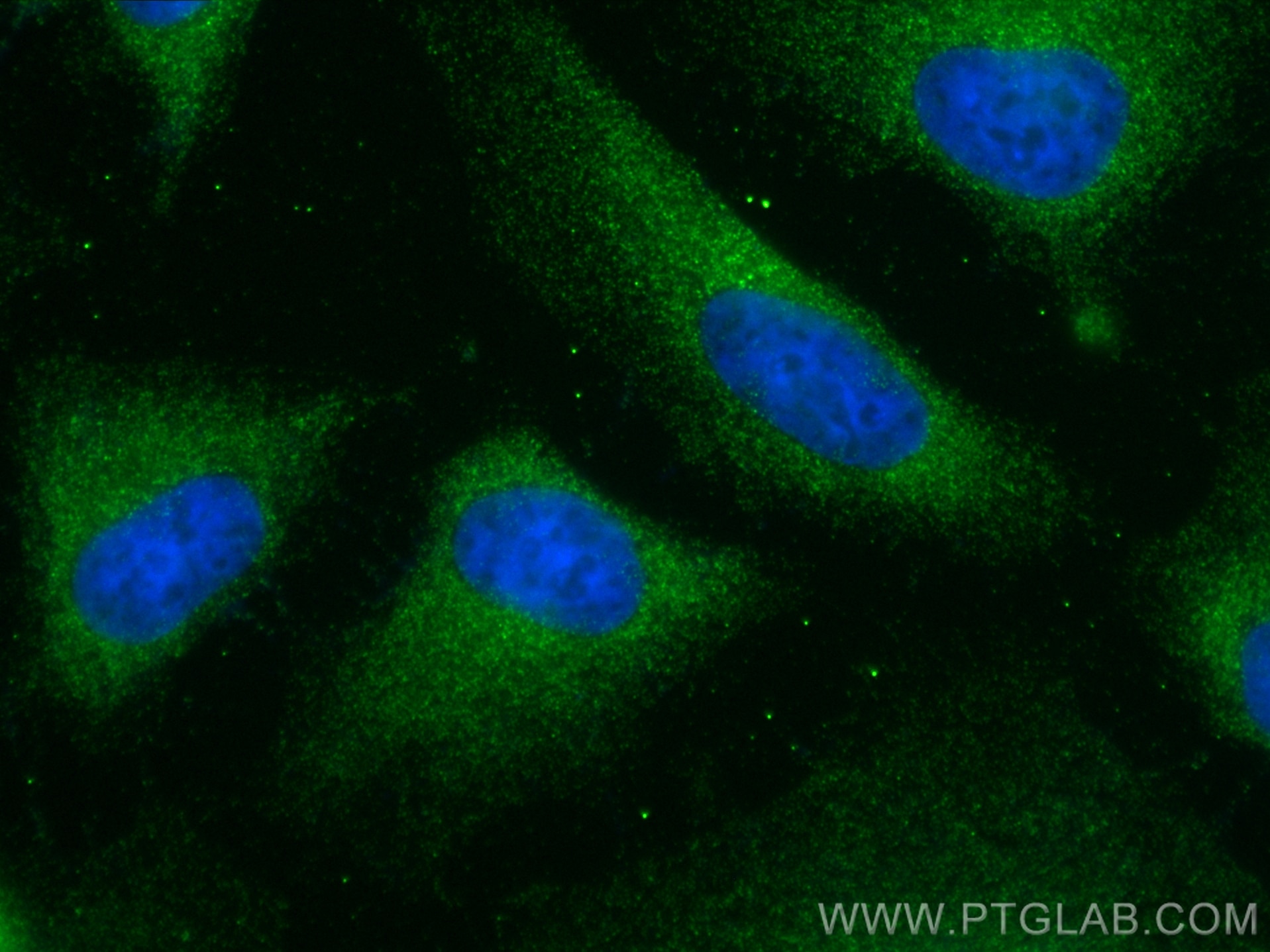 Immunofluorescence (IF) / fluorescent staining of HeLa cells using NKIRAS2 Polyclonal antibody (10174-1-AP)