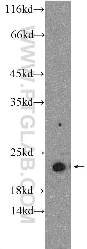 Western Blot (WB) analysis of HEK-293 cells using NKIRAS2 Polyclonal antibody (10174-1-AP)