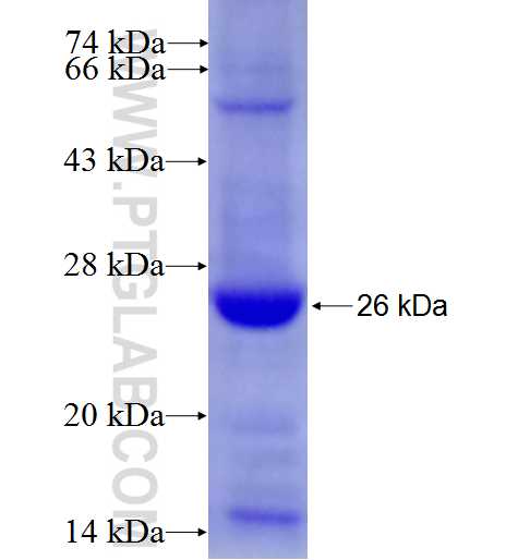 NKPD1 fusion protein Ag27667 SDS-PAGE