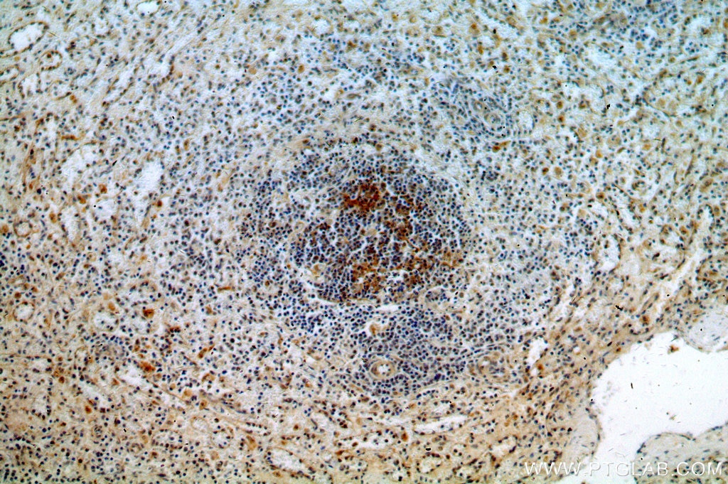 Immunohistochemistry (IHC) staining of human spleen tissue using NKTR Polyclonal antibody (19978-1-AP)