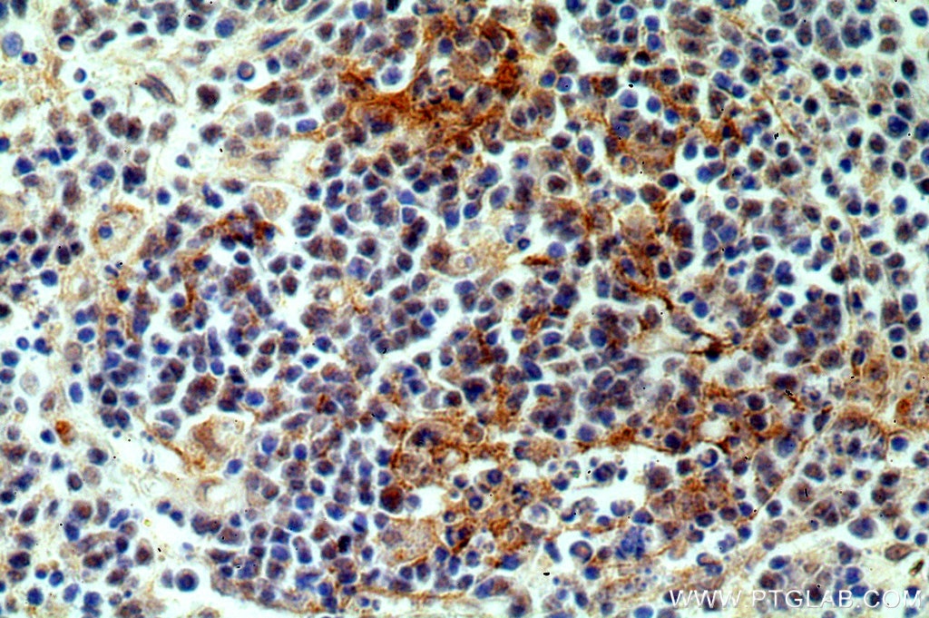 Immunohistochemistry (IHC) staining of human spleen tissue using NKTR Polyclonal antibody (19978-1-AP)