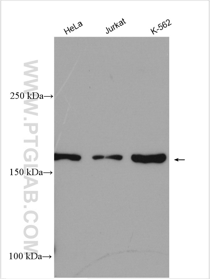 Western Blot (WB) analysis of various lysates using NKTR Polyclonal antibody (19978-1-AP)