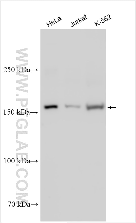 Western Blot (WB) analysis of various lysates using NKTR Polyclonal antibody (19978-1-AP)