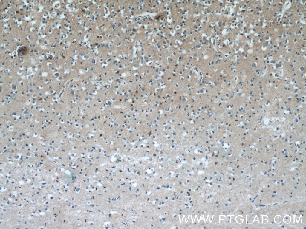 Immunohistochemistry (IHC) staining of human brain tissue using NKX1-2 Polyclonal antibody (55484-1-AP)