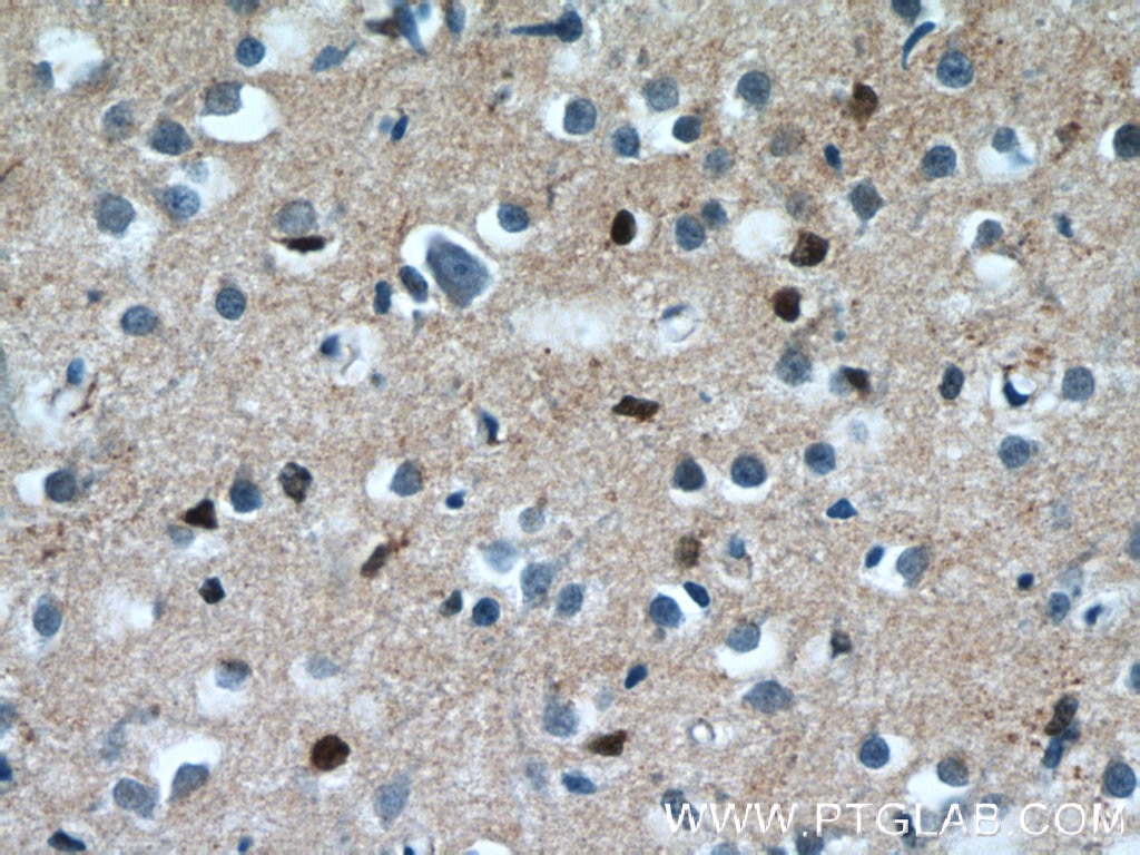 Immunohistochemistry (IHC) staining of human brain tissue using NKX1-2 Polyclonal antibody (55484-1-AP)