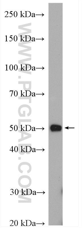 Western Blot (WB) analysis of mouse lung tissue using TTF1; NKX2-1 Polyclonal antibody (21777-1-AP)