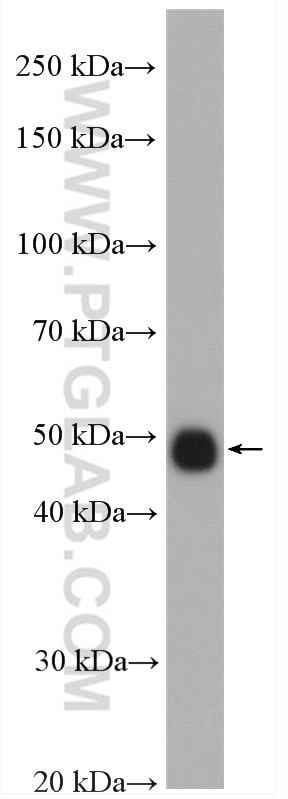 Western Blot (WB) analysis of mouse brain tissue using TTF1; NKX2-1 Polyclonal antibody (21777-1-AP)