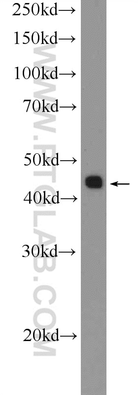 Western Blot (WB) analysis of A549 cells using TTF1; NKX2-1 Polyclonal antibody (21777-1-AP)