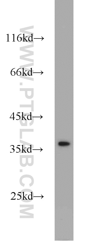 Western Blot (WB) analysis of HeLa cells using TTF1; NKX2-1 Polyclonal antibody (21777-1-AP)