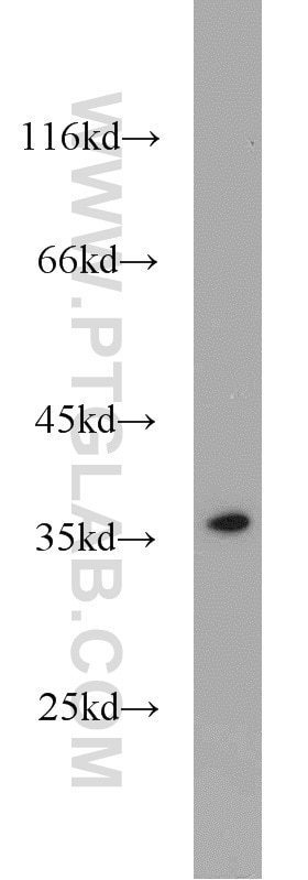 Western Blot (WB) analysis of HeLa cells using TTF1; NKX2-1 Polyclonal antibody (21777-1-AP)