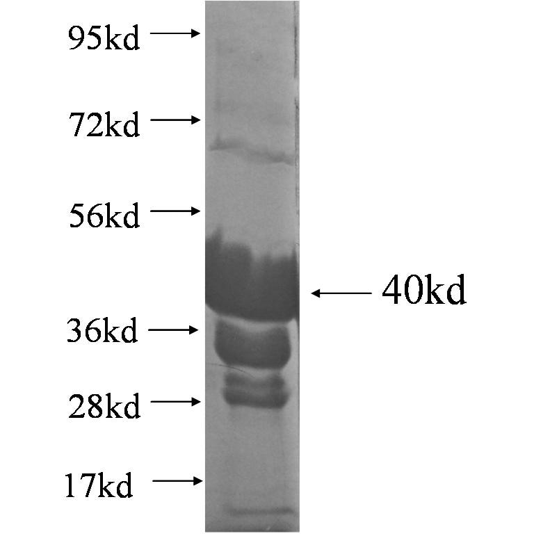 NKX2-2 fusion protein Ag4069 SDS-PAGE