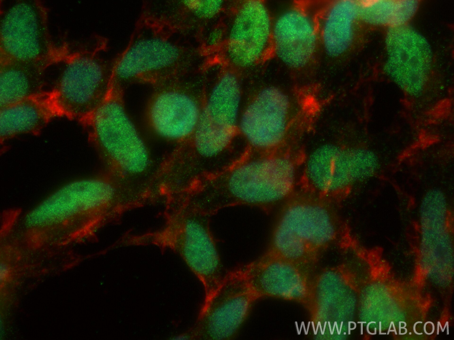 Immunofluorescence (IF) / fluorescent staining of HEK-293 cells using NKX2-4 Polyclonal antibody (33052-1-AP)