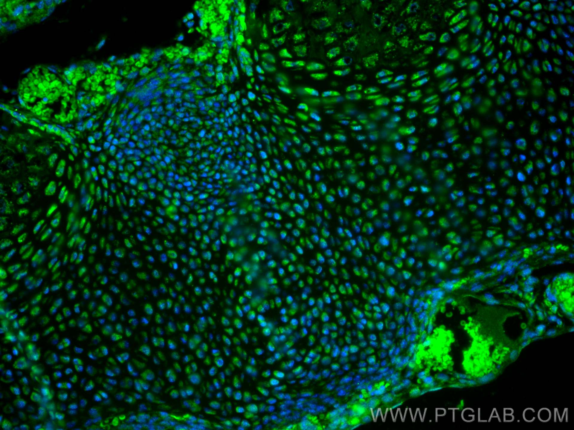 Immunofluorescence (IF) / fluorescent staining of mouse embryo tissue using NKX2-5 Polyclonal antibody (13921-1-AP)