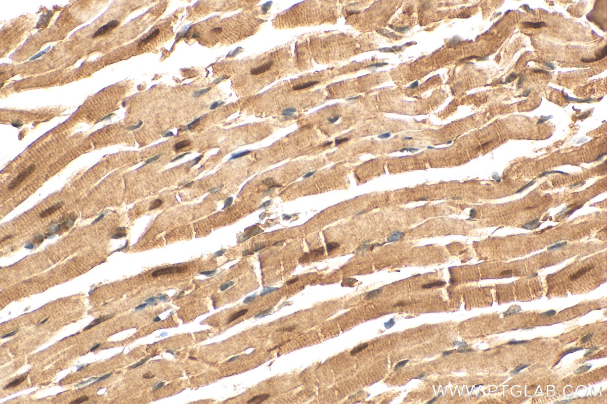 Immunohistochemistry (IHC) staining of mouse heart tissue using NKX2-5 Polyclonal antibody (13921-1-AP)