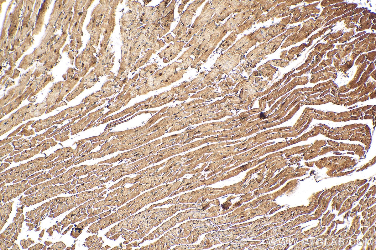 Immunohistochemistry (IHC) staining of mouse heart tissue using NKX2-5 Polyclonal antibody (13921-1-AP)