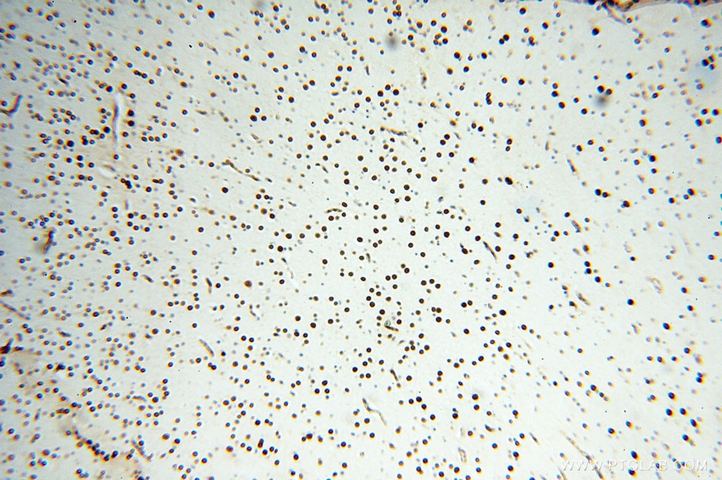 IHC staining of human brain using 13921-1-AP