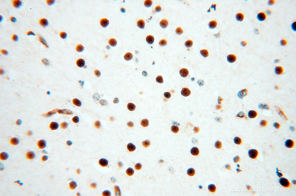 IHC staining of human brain using 13921-1-AP