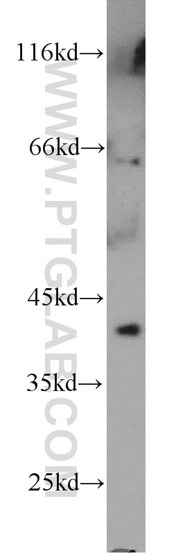 Western Blot (WB) analysis of human heart tissue using NKX2-5 Polyclonal antibody (13921-1-AP)