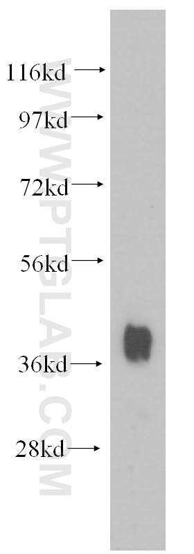 Western Blot (WB) analysis of human heart tissue using NKX2-5 Polyclonal antibody (13921-1-AP)