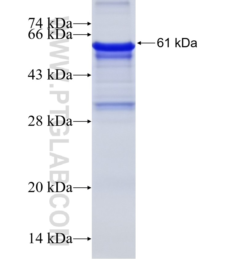 NKX2-5 fusion protein Ag4930 SDS-PAGE