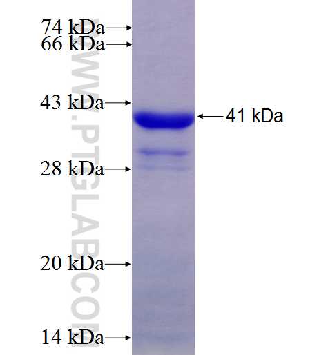 NKX2-5 fusion protein Ag5534 SDS-PAGE