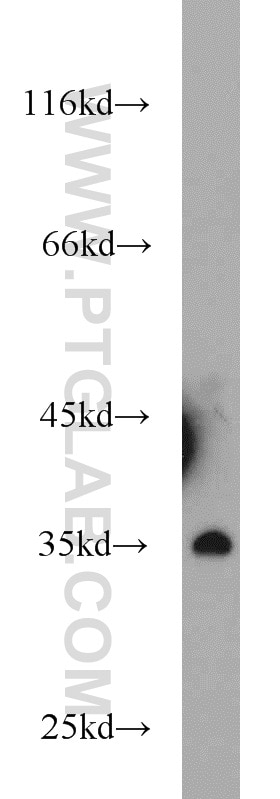 Western Blot (WB) analysis of human testis tissue using NKX3-1 Polyclonal antibody (13069-1-AP)