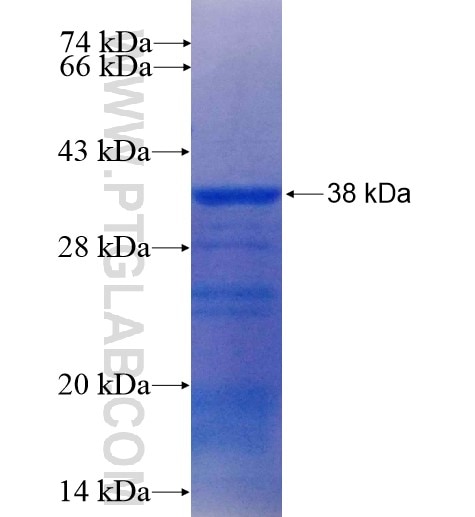 NKX3-1 fusion protein Ag14496 SDS-PAGE