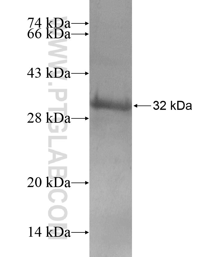 NKX3-1 fusion protein Ag17305 SDS-PAGE