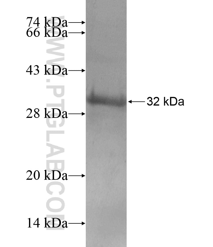 NKX3-1 fusion protein Ag17305 SDS-PAGE