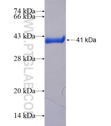 NKX3-2 fusion protein Ag17581 SDS-PAGE
