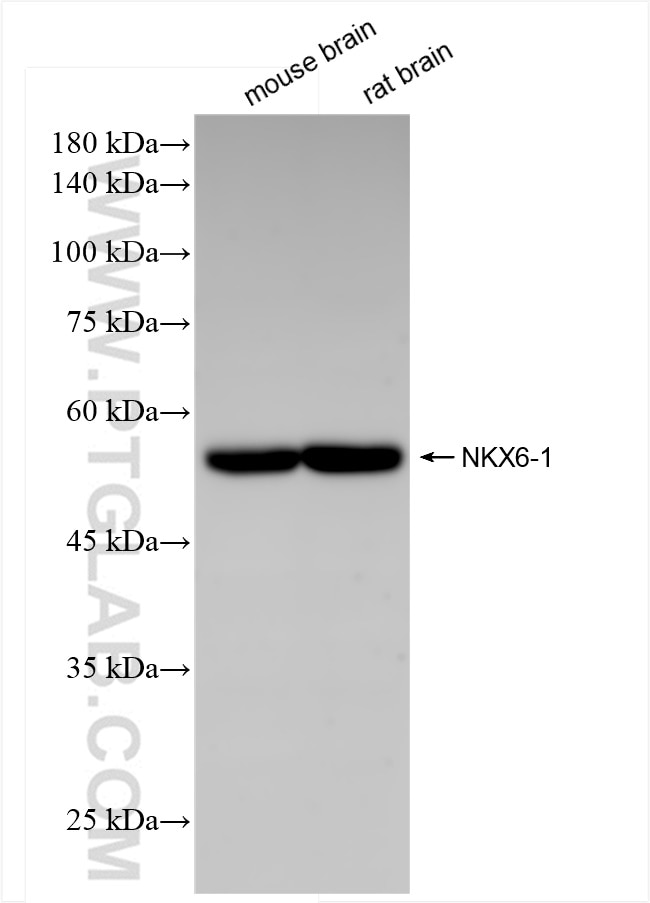 Western Blot (WB) analysis of various lysates using NKX6-1 Recombinant antibody (84355-1-RR)