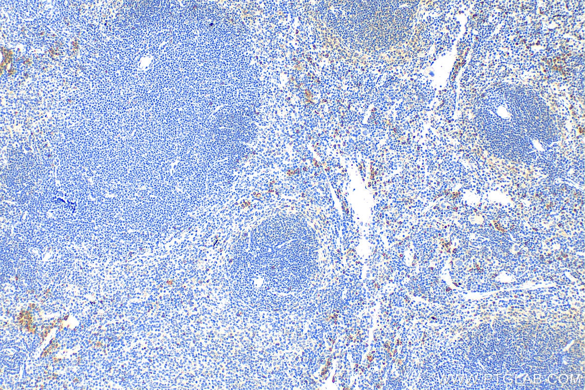Immunohistochemistry (IHC) staining of mouse spleen tissue using NKp46/NCR1 Polyclonal antibody (31984-1-AP)