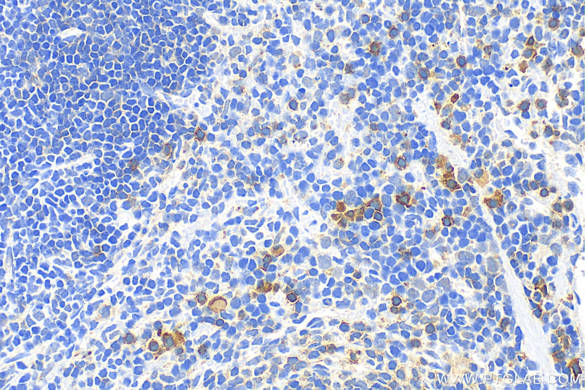 Immunohistochemistry (IHC) staining of mouse spleen tissue using NKp46/NCR1 Polyclonal antibody (31984-1-AP)