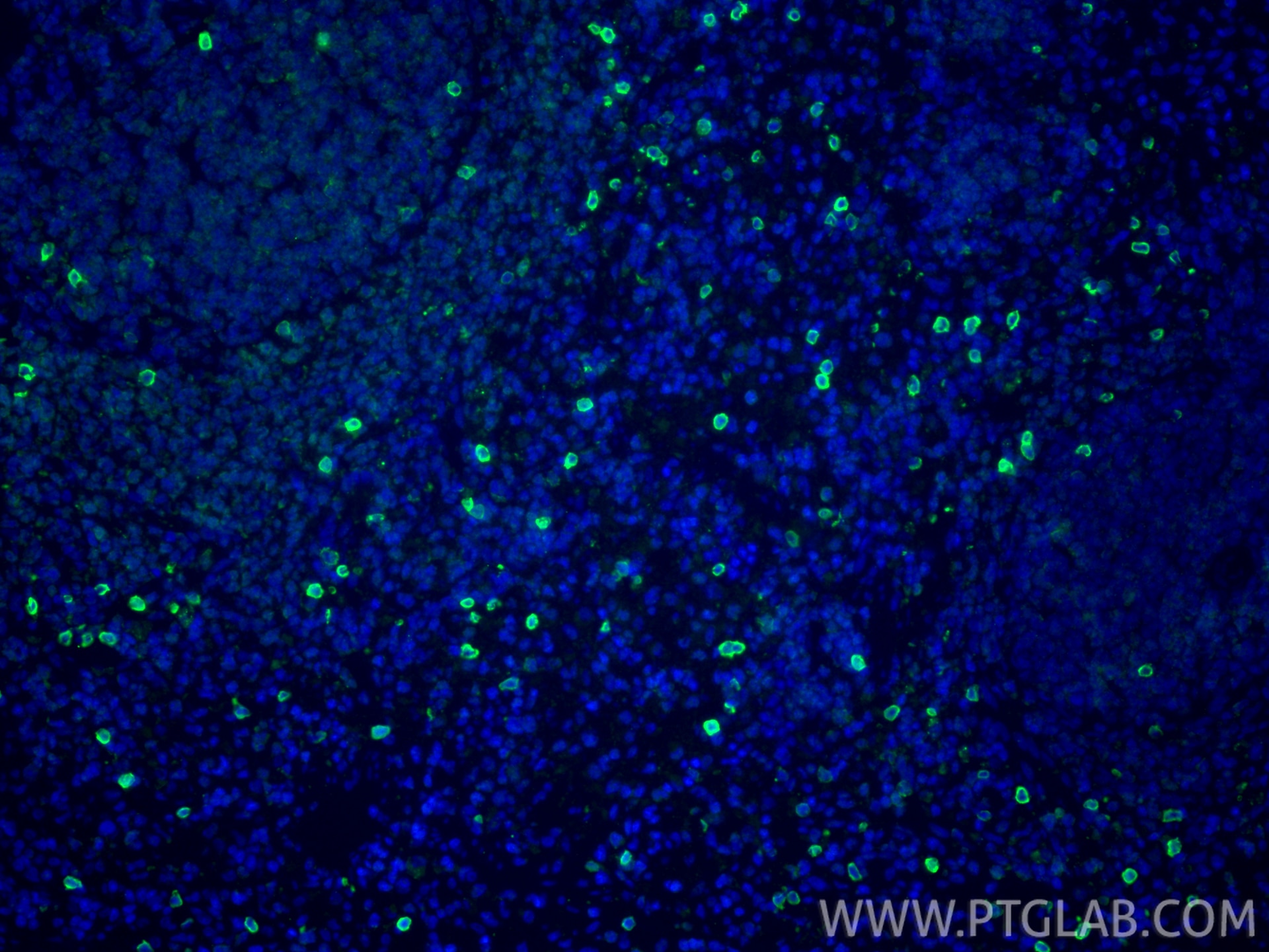 Immunofluorescence (IF) / fluorescent staining of rat spleen tissue using NKp46/NCR1 Recombinant monoclonal antibody (84416-5-RR)