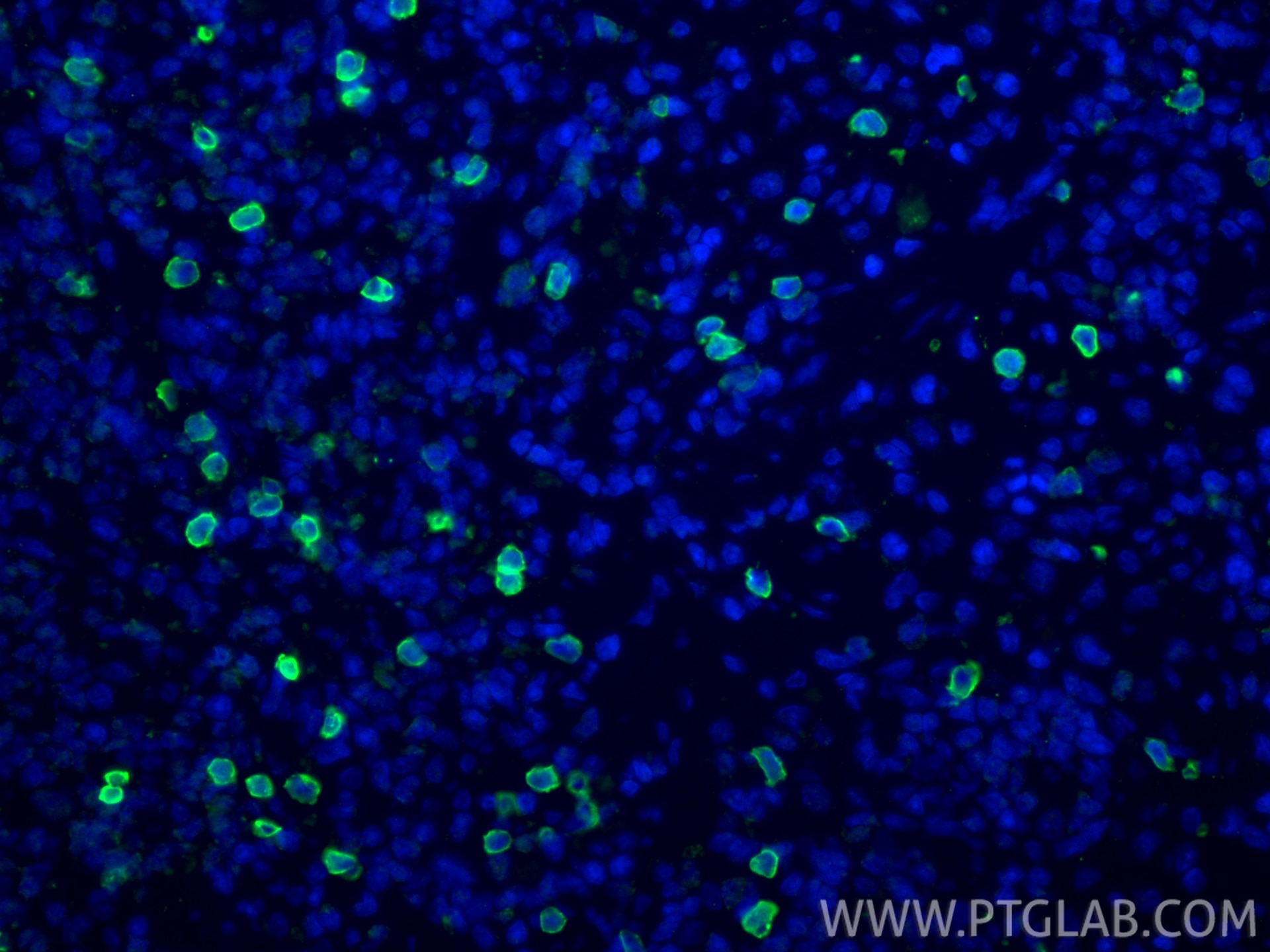 Immunofluorescence (IF) / fluorescent staining of rat spleen tissue using NKp46/NCR1 Recombinant monoclonal antibody (84416-5-RR)