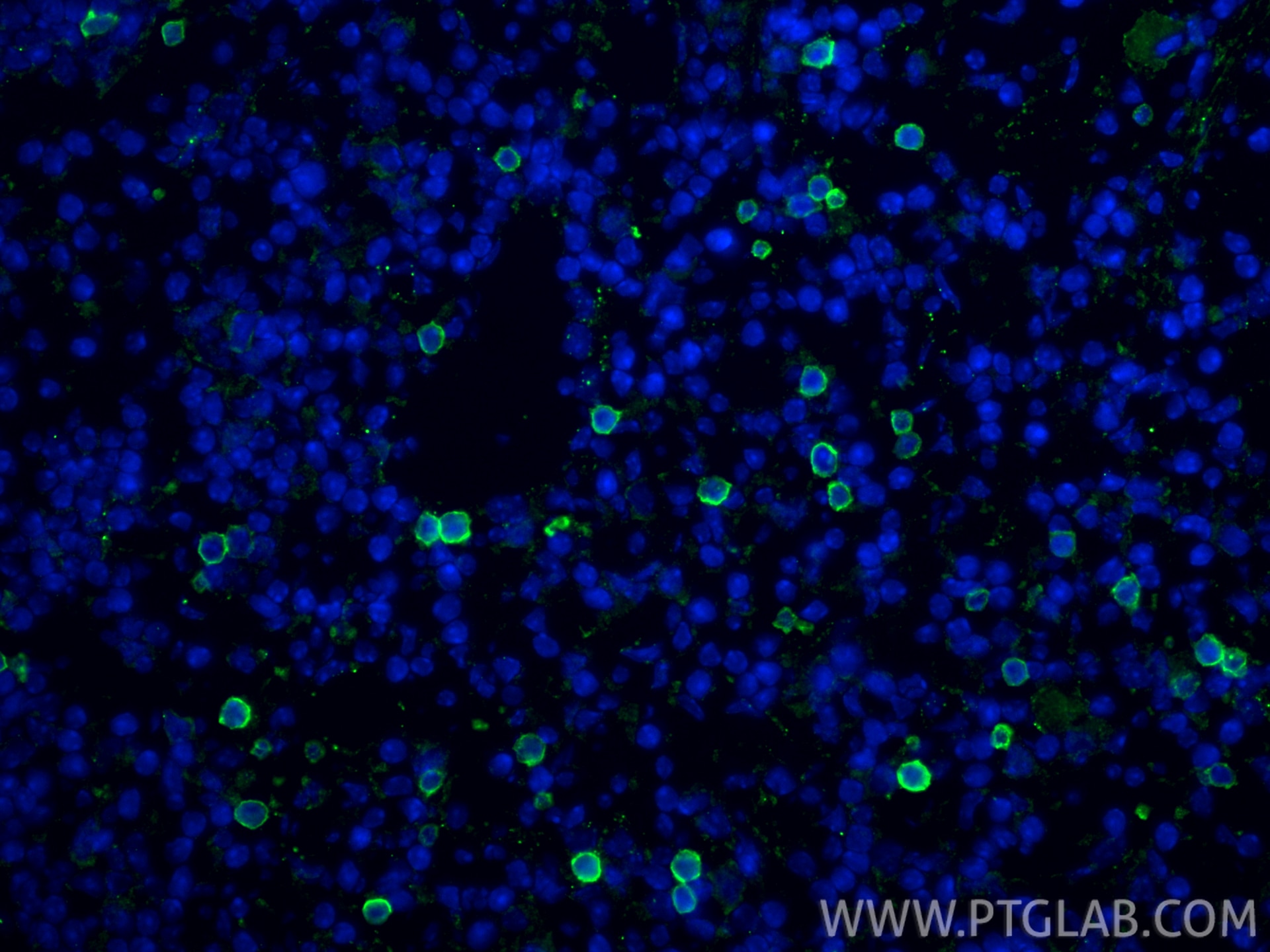 Immunofluorescence (IF) / fluorescent staining of mouse spleen tissue using NKp46/NCR1 Recombinant monoclonal antibody (84416-5-RR)