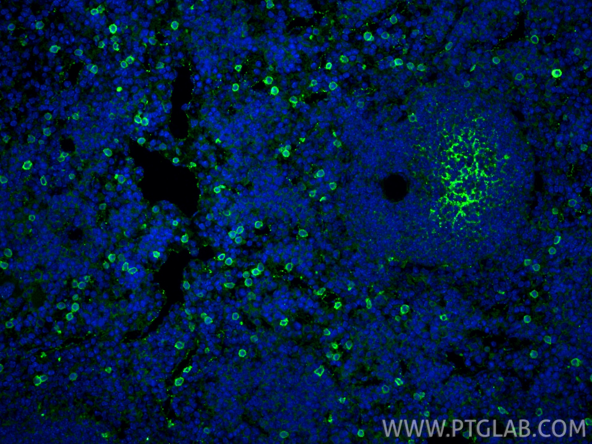 Immunofluorescence (IF) / fluorescent staining of mouse spleen tissue using NKp46/NCR1 Recombinant monoclonal antibody (84416-5-RR)