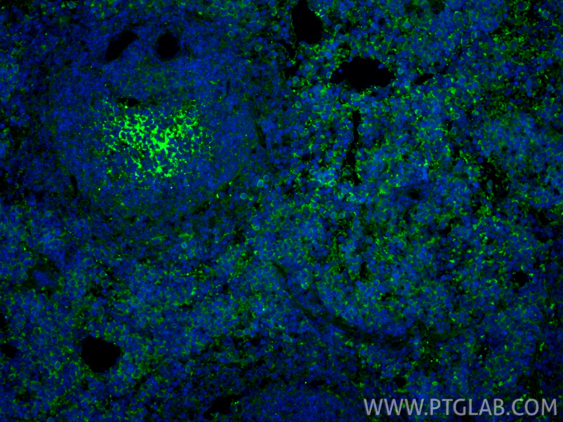 Immunofluorescent analysis of (4% PFA) fixed paraffin-embedded mouse spleen tissue using CoraLite® Plus 488 NKp46/NCR1 antibody (CL488-84416-5, Clone: 241811H7 ) at dilution of 1:200. Heat mediated antigen retrieval with Tris-EDTA buffer (pH 9.0). Immunofluorescence (IF) / fluorescent staining of mouse spleen tissue using CoraLite® Plus 488-conjugated NKp46/NCR1 Recombina (CL488-84416-5)
