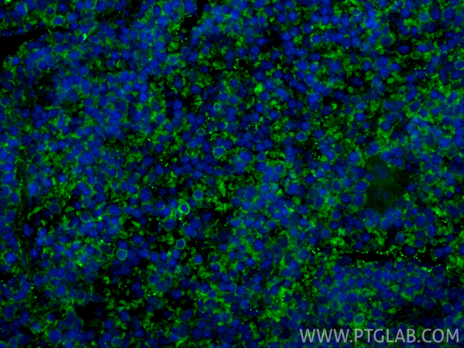 Immunofluorescent analysis of (4% PFA) fixed paraffin-embedded mouse spleen tissue using CoraLite® Plus 488 NKp46/NCR1 antibody (CL488-84416-5, Clone: 241811H7 ) at dilution of 1:200. Heat mediated antigen retrieval with Tris-EDTA buffer (pH 9.0). Immunofluorescence (IF) / fluorescent staining of mouse spleen tissue using CoraLite® Plus 488-conjugated NKp46/NCR1 Recombina (CL488-84416-5)