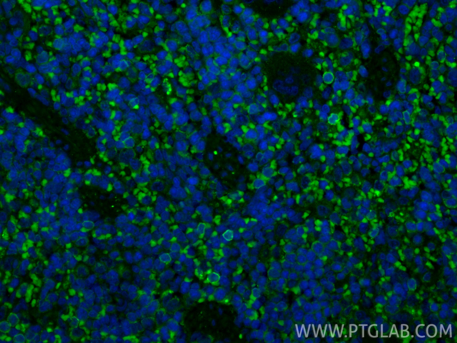 Immunofluorescent analysis of (4% PFA) fixed paraffin-embedded rat spleen tissue using CoraLite® Plus 488 NKp46/NCR1 antibody (CL488-84416-5, Clone: 241811H7 ) at dilution of 1:200. Heat mediated antigen retrieval with Tris-EDTA buffer (pH 9.0). Immunofluorescence (IF) / fluorescent staining of rat spleen tissue using CoraLite® Plus 488-conjugated NKp46/NCR1 Recombina (CL488-84416-5)