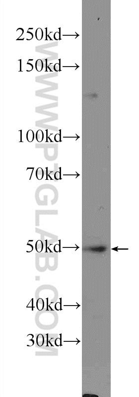 Western Blot (WB) analysis of BxPC-3 cells using NLE1 Polyclonal antibody (16419-1-AP)