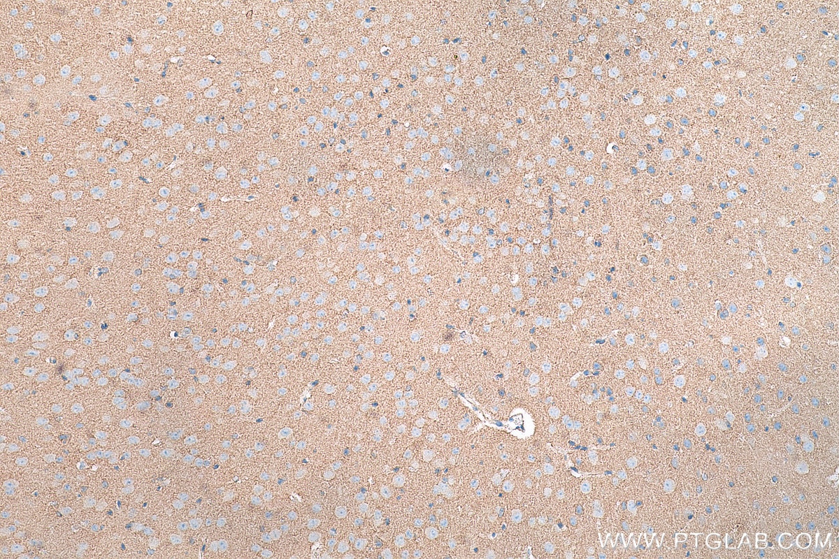 Immunohistochemistry (IHC) staining of mouse brain tissue using NLGN1 Monoclonal antibody (66964-1-Ig)