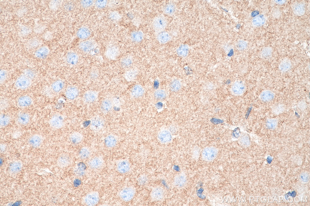 Immunohistochemistry (IHC) staining of mouse brain tissue using NLGN1 Monoclonal antibody (66964-1-Ig)