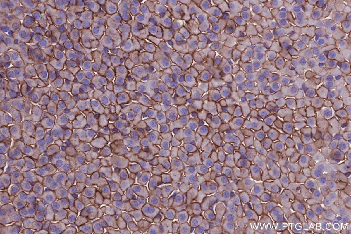 Immunohistochemistry (IHC) staining of mouse adrenal gland tissue using NLGN1 Monoclonal antibody (66964-1-Ig)