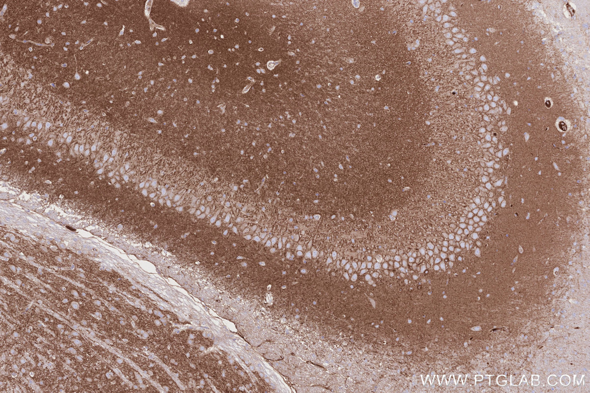 Immunohistochemistry (IHC) staining of rat brain tissue using NLGN1 Monoclonal antibody (66964-1-Ig)